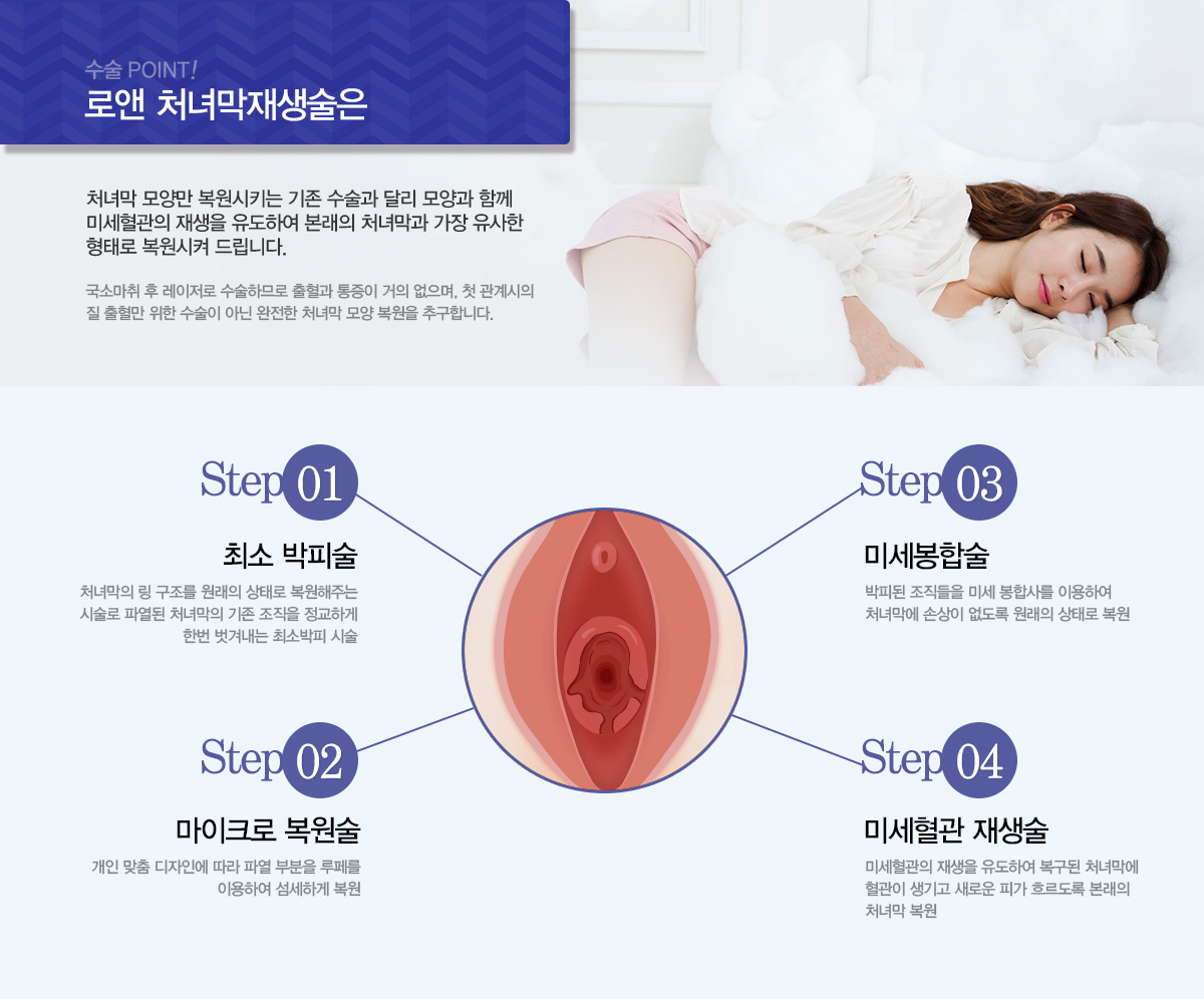 처녀막재생술,처녀막재생수술,혈흔수술,질성형수술,질성형수술후기