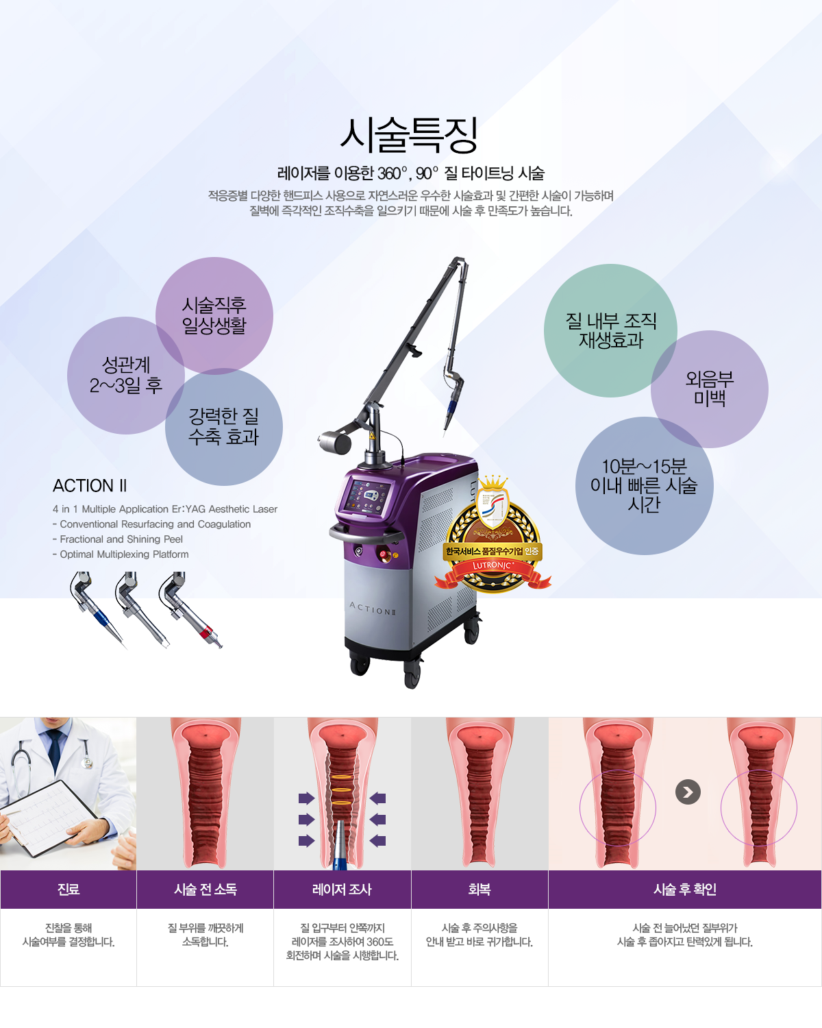 시술특징 레이저를 이용한 360도, 90도 질 타이트닝 시술