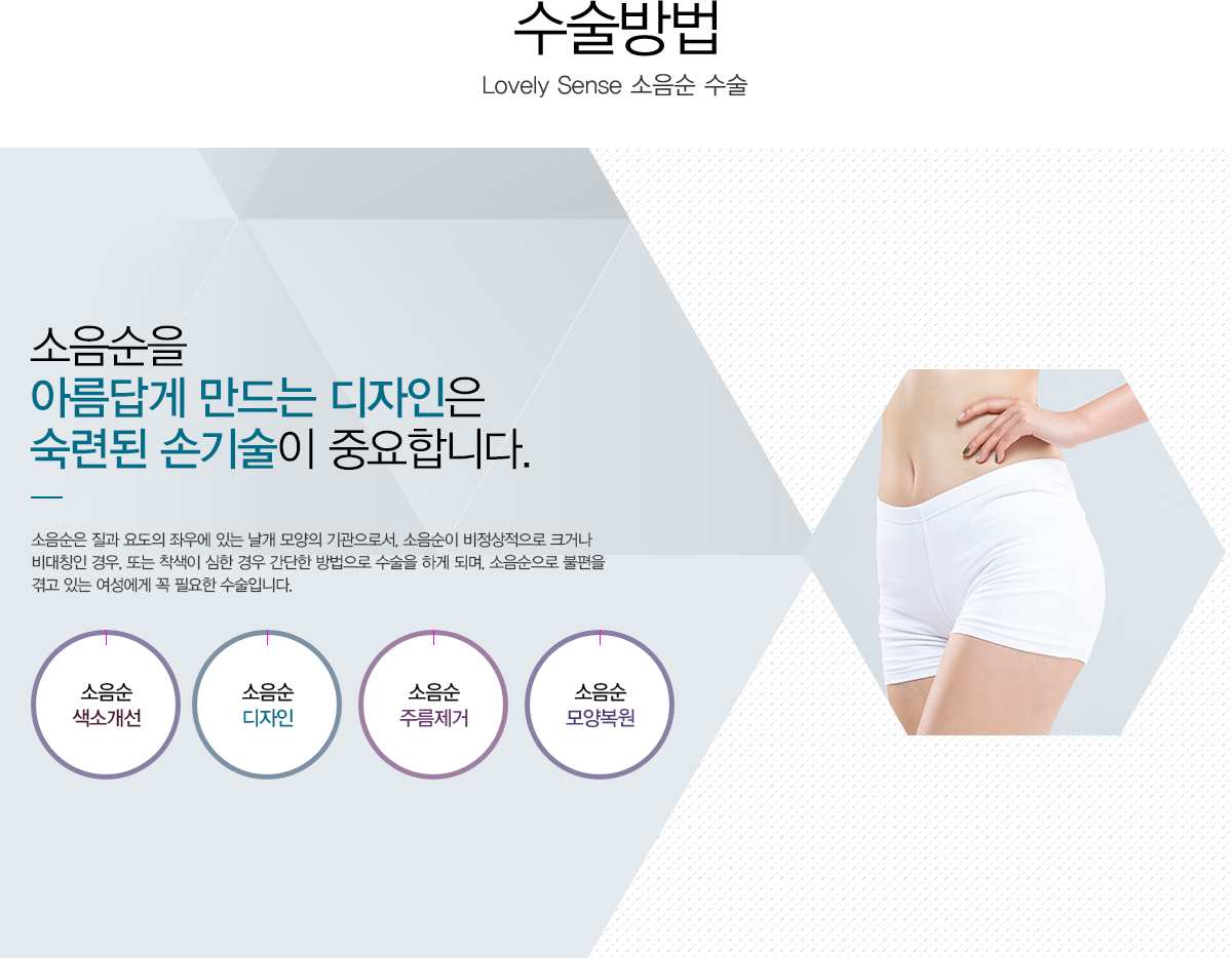 소음순성형