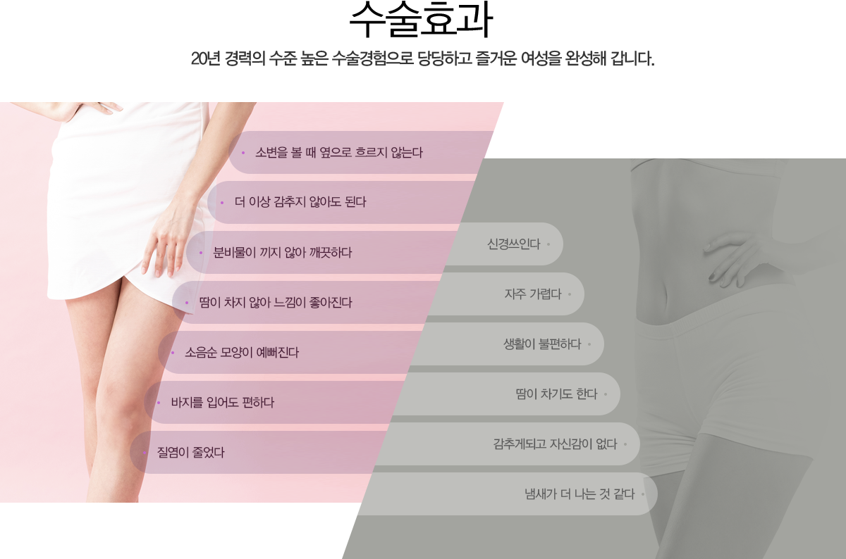 수술효과 20년 경력의 수준 높은 수술경험으로 당당하고 즐거운 여성을 완성해 갑니다.